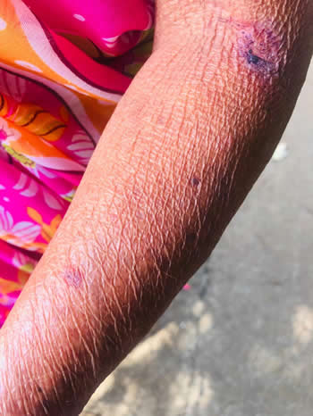 Soonaynee, 72 ans, a été attaquée par les deux rottweillers de son petit-fils.