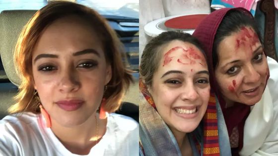 Hazel Keech : l'actrice d'origine mauricienne se fait refaire le nez