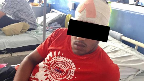 Agression sanglante à Montagne-Blanche : un jeune reçoit un violent coup de tuyau à la tête