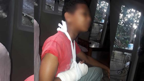 Allégation d’agression en classe : un écolier de 11 ans se retrouve avec un bras plâtré