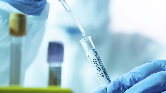 COVID-19 : une réglementation des prix des tests PCR souhaitée