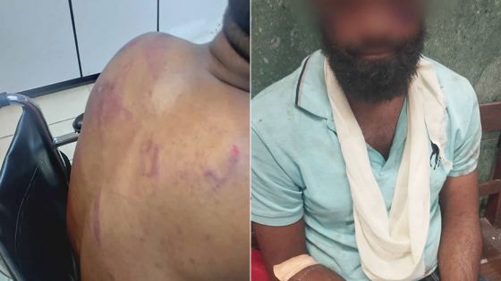 Arrestation musclée à Port-Louis : un homme de 32 ans crie à la brutalité policière 