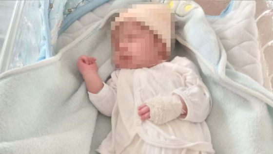 Un nouveau-né perd son auriculaire - Ashvina Clément, la maman : « J’étais sous le choc »