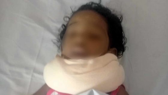 Lors d’une bagarre : un bébé blessé par un coup de sabre