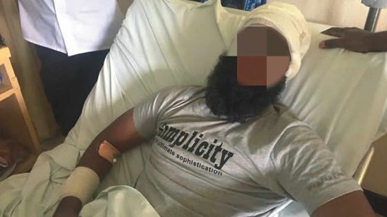 Rixe sanglante à Curepipe : deux marchands ambulants hospitalisés