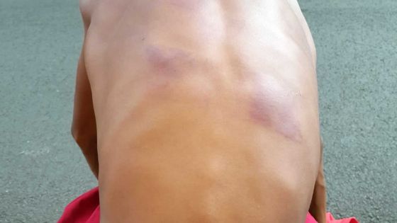 À cause d’un téléphone égaré : un ado de 12 ans agressé avec la queue d’une raie