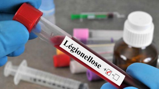 Santé - Légionellose : ce qu’il faut savoir