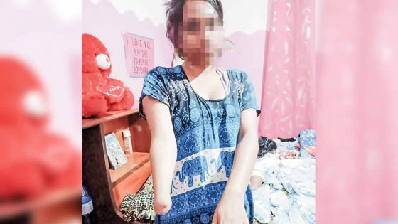 Née avec une malformation : la bataille de Tarushi, 18 ans, pour sa dignité