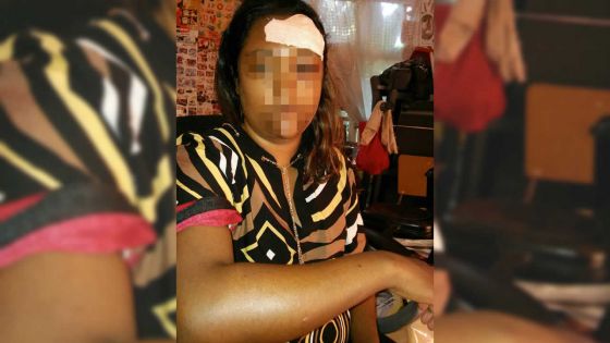 Nuit de terreur à Îlot : agressé par huit malfrats, un couple vit dans la peur