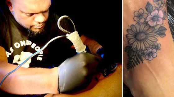 David Serret : « Possible de se faire tatouer lorsqu’on a le vitiligo »