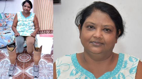 Amputée des deux pieds - Venita Purbhoo : «Marcher à nouveau est comme une seconde naissance»