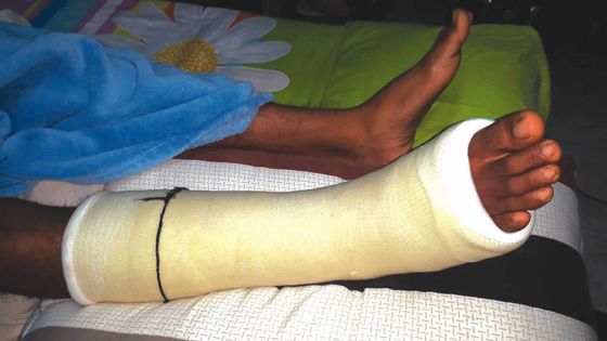Loisir extrême : un jeune se blesse après un saut de 12 mètres au Caudan