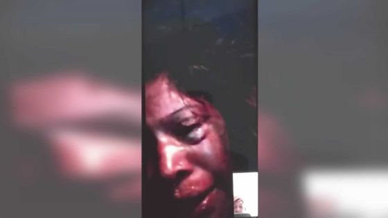 Filmée en train de se faire agresser par son époux : « Mo ex inn provok mo mari », lâche la femme