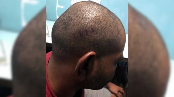 Brutalité policière alléguée - Me Anoup Goodaree : «Ce n’est pas à la police de faire justice»