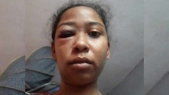 Soupçonnée d’infidélité par son mari : une femme de 26 ans agressée à coups de barre de fer