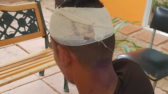 Dans l’enceinte du poste de police de Vallée-Pitot : il reçoit de violents coups de canif à la tête
