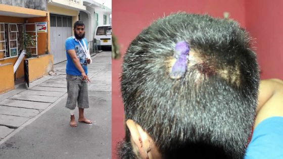 Vol avec violence et règlement de compte allégués : un jeune brutalisé par six personnes