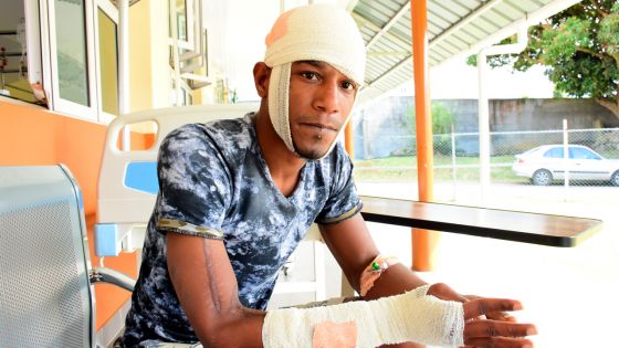 À Eau-Coulée : par vengeance, un jeune de 27 ans agressé à coups de sabre
