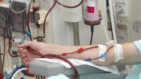 Dialyse : la fille d’une patiente déplore un manque de places