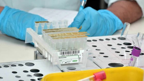 Positif à la Covid-19 : décès d’un patient sous dialyse ce soir