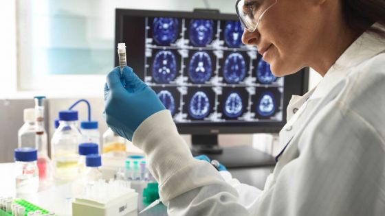 Résultats prometteurs pour un nouveau traitement contre Alzheimer