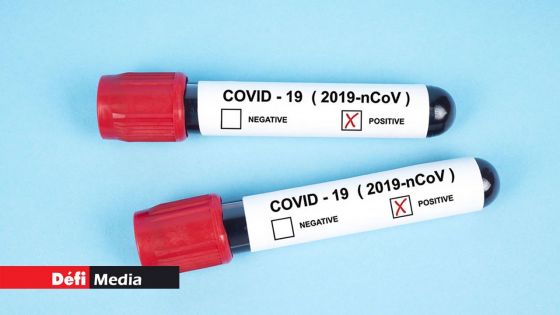 Covid-19 : 188 cas positifs ; 51 admissions