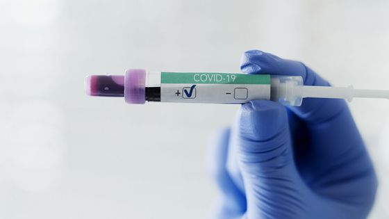 Covid-19 : 17 cas positifs enregistrés ces dernières 24 heures 
