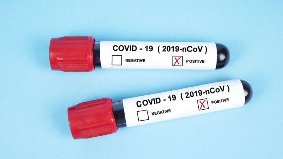 Covid-19 : 126 cas positifs enregistrés ces dernières 24 heures