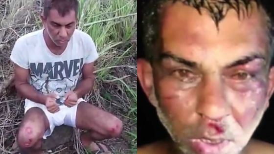 Il raconte son enlèvement et son agression : «Nou pu bizin sott to deux poignets ek to sexe», lancent ses ravisseurs