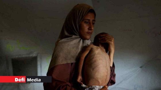 La catastrophe à Gaza rappelle les famines en Ethiopie et au Biafra, selon l'ONU