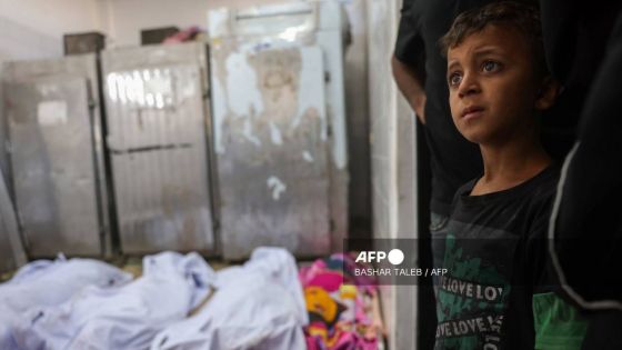 Gaza : 42 000 blessés souffrent de séquelles invalidantes, selon l’OMS
