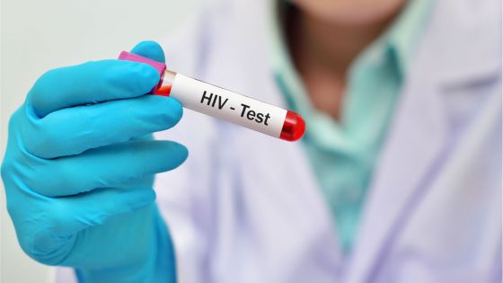 VIH/SIDA : la tendance se maintient chez les 25-44 ans