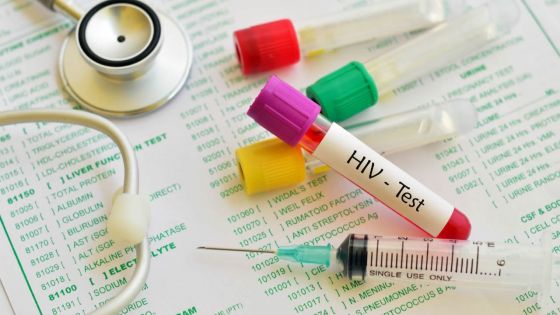 Introduction du HIV and Aids (Amendment) Bill 