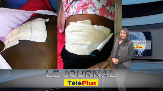 Le JT - La Valette, Bambous : une femme de 29 ans agressée sauvagement à la tronçonneuse
