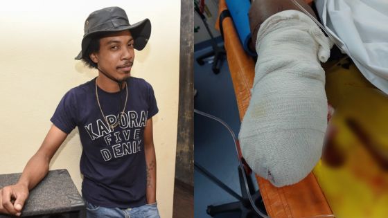Lino Louis a une jambe sectionnée lors d’un accident de la route