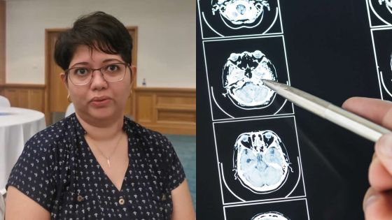 Intervention chirurgicale rare en INDE : Nashila Bibi Sakhabuth surmonte sept anévrismes sacculaires au cerveau