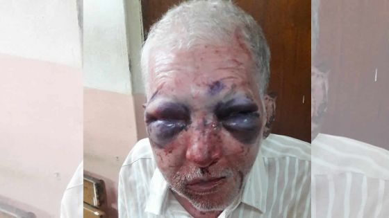 Agression : le calvaire de Tibye Najim, 66 ans, agressé à coups de pierre