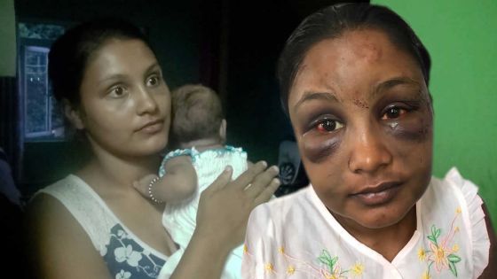 Violence conjugale : Yashna redoute la vengeance de son mari libéré sous caution