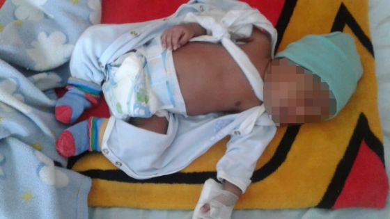 Dans un hôpital public : le bras de leur bébé se brise à l’accouchement