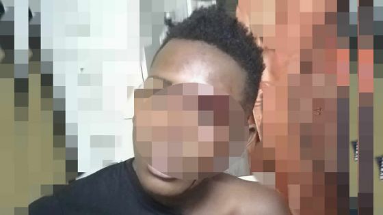 Un pompier dépouillé et agressé au sabre : un suspect de 17 ans, battu et remis à la police par le public