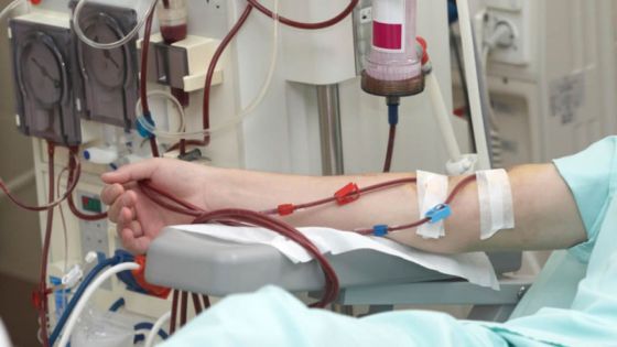 Covid-19/patients dialysés : un Fact-Finding Committee mis sur pied