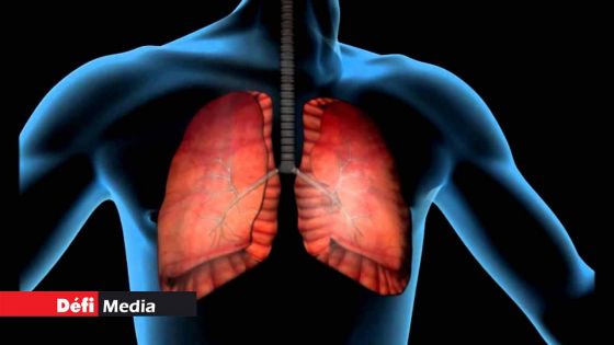 Tuberculose - un cas détecté et les 17 autres tests négatifs : «La situation est sous contrôle», indique le ministère de la Santé