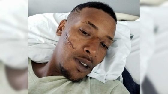 Agression sanglante dans le métro : Steward Pierre, 35 ans, dit avoir vu la mort de près