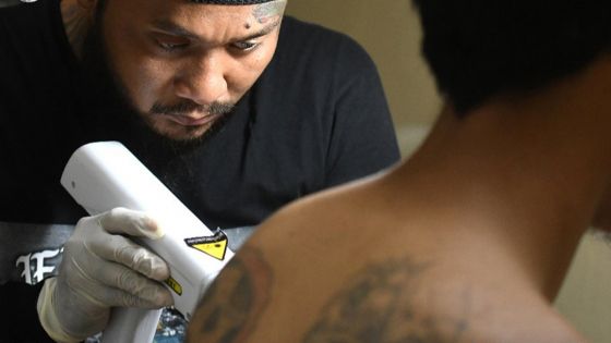 Tatouages : après l'encre, les aiguilles suspectées de susciter des allergies