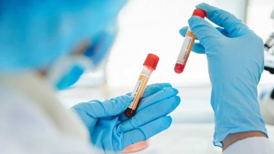 Covid-19 : votre groupe sanguin pourrait déterminer vos risques d’être infecté, révèle une étude