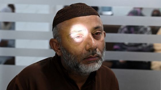 Un médecin examinant un patient souffrant d'une infection oculaire dans un hôpital de Lahore, le 27 septembre 2023.