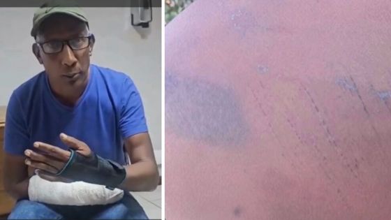 Bois d’Oiseaux – Sauvagement agressé, il remet une vidéo accablante à la police, mais attend toujours justice