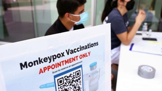 La variole du singe désormais urgence de santé publique aux Etats-Unis