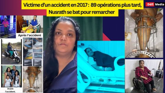 Victime d’un accident en 2017 :  89 opérations plus tard, Nusrath se bat pour remarcher 