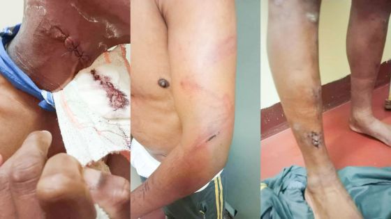 Violences à la prison de Melrose : des hauts gradés dans le collimateur de la MCIT 